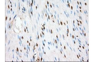 Image no. 10 for anti-Transforming, Acidic Coiled-Coil Containing Protein 3 (TACC3) antibody (ABIN1498099) (TACC3 antibody)