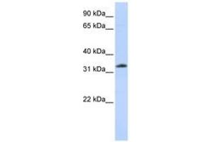Image no. 1 for anti-Siah E3 Ubiquitin Protein Ligase 2 (SIAH2) (N-Term) antibody (ABIN6744237)