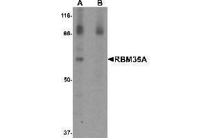 Western Blotting (WB) image for anti-Epithelial Splicing Regulatory Protein 1 (ESRP1) (N-Term) antibody (ABIN1031534) (ESRP1 antibody  (N-Term))