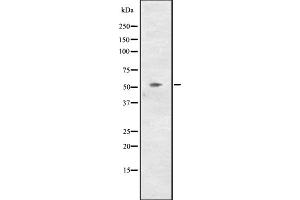 Western blot analysis of CCNL2 expression in NCI-H460 cell line lysates ,The lane on the left is treated with the antigen-specific peptide.