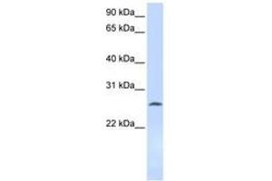 Image no. 1 for anti-Deoxycytidine Kinase (DCK) (AA 108-157) antibody (ABIN6743592) (DCK antibody  (AA 108-157))
