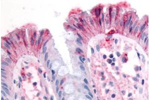 Anti-MST1R / RON antibody  ABIN1049083 IHC staining of human colon, surface epithelium. (MST1R antibody  (N-Term))