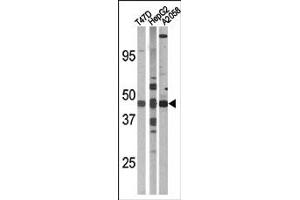 Image no. 2 for anti-E2F Transcription Factor 1 (E2F1) (pSer337) antibody (ABIN358119) (E2F1 antibody  (pSer337))