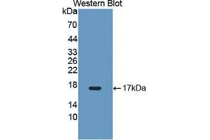 Western blot analysis of the recombinant protein. (NR4A3 antibody  (AA 29-145))