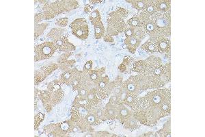 Immunohistochemistry of paraffin-embedded human liver using [KO Validated] Glutamine Synthetase (Glutamine Synthetase (GLUL)) Rabbit pAb (ABIN6130425, ABIN6141161, ABIN6141162 and ABIN7101772) at dilution of 1:150 (40x lens).