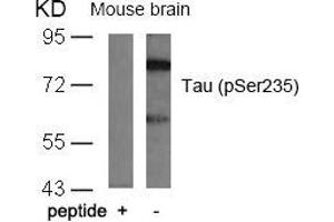 Western blot analysis of extracts from mouse brain tissue using Tau(Phospho-Ser235) Antibody and the same antibody preincubated with blocking peptide. (MAPT antibody  (pSer235))
