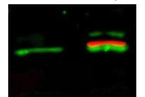 Immunofluorescence (IF) image for anti-V-Akt Murine Thymoma Viral Oncogene Homolog 1 (AKT1) (Ser473) antibody (ABIN400784) (AKT1 antibody  (Ser473))