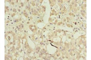Immunohistochemistry of paraffin-embedded human adrenal gland tissue using ABIN7144386 at dilution of 1:100