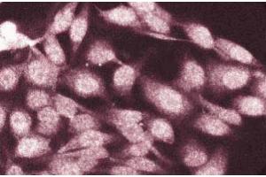 Immunofluorescence staining of HeLa cells. (CTNNA1 antibody  (AA 729-906))