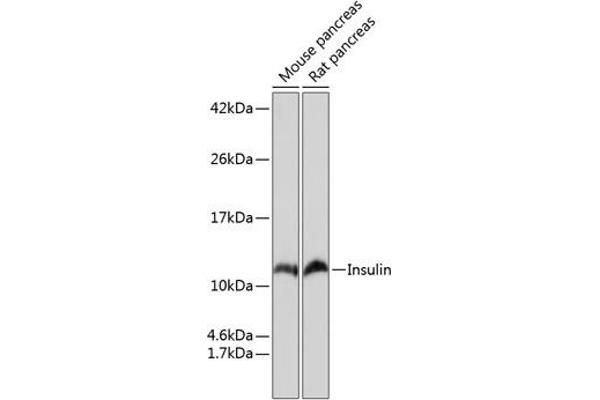 Insulin antibody