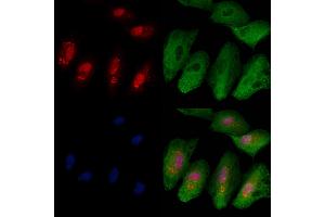 ABIN6263540 and ABIN6279810 staining  cells by IF/ICC.