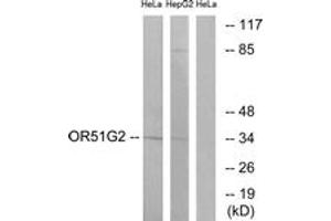 Western blot analysis of extracts from HeLa/HepG2 cells, using OR51G2 Antibody. (OR51G2 antibody  (AA 211-260))