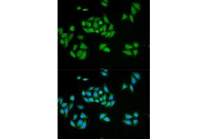 Immunofluorescence analysis of HeLa cell using UPF1 antibody. (RENT1/UPF1 antibody  (AA 270-370))