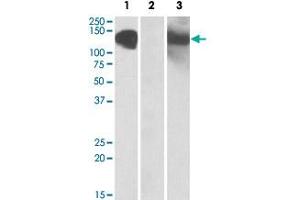 HEK293 lysate (10 ug protein in RIPA buffer) overexpressing human CDH11 with C-terminal MYC tag probed with CDH11 polyclonal antibody  (1 ug/mL) in Lane 1 and probed with anti-MYC Tag (1/1000) in Lane 3. (OB Cadherin antibody  (AA 26-37))