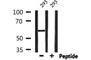 Western blot analysis of extracts from 293, using YTHDF1 Antibody. (YTHDF1 antibody  (N-Term))