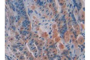 Immunohistochemistry (IHC) image for anti-Transcription Factor A, Mitochondrial (TFAM) (AA 43-243) antibody (ABIN7438793)