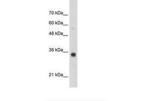 Image no. 1 for anti-Homeobox B4 (HOXB4) (N-Term) antibody (ABIN203345) (HOXB4 antibody  (N-Term))