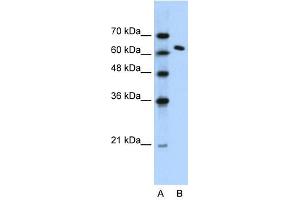 SUPT16H antibody (20R-1066) used at 0. (SUPT16H antibody  (N-Term))