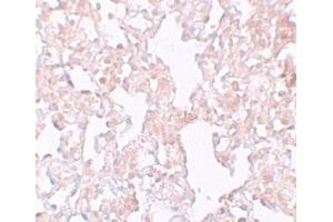Immunohistochemistry (IHC) image for anti-Major Facilitator Superfamily Domain Containing 1 (MFSD1) (Middle Region) antibody (ABIN1031003) (MFSD1 antibody  (Middle Region))