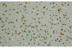 Immunohistochemistry of paraffin-embedded mouse brain using Phospho-AMPK alpha1/2 (Thr183/172) Polyclonal Antibody at dilution of 1:50 (PRKAA1/PRKAA2 antibody  (pThr172, pThr183))