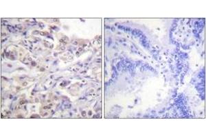 Immunohistochemistry (IHC) image for anti-Heterogeneous Nuclear Ribonucleoprotein D (HNRNPD) (AA 49-98), (pSer83) antibody (ABIN1531657)