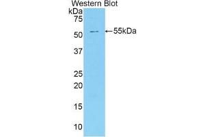 Western blot analysis of the recombinant protein. (SMPD2 antibody  (AA 2-236))