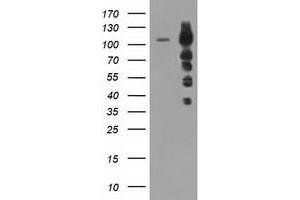 HEK293T cells were transfected with the pCMV6-ENTRY control (Left lane) or pCMV6-ENTRY TACC3 (Right lane) cDNA for 48 hrs and lysed. (TACC3 antibody)
