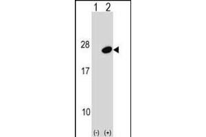 Western blot analysis of UBE2G1 (arrow) using rabbit polyclonal UBE2G1 Antibody (C-term) (ABIN1536693 and ABIN2848805). (UBE2G1 antibody  (C-Term))