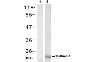 Western blot analysis of extracts from Hela cell using stathmin1 (Ab-62) Antibody (E021518, Lane 1 and 2 ) (Stathmin 1 antibody)