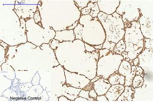 Immunohistochemical analysis of paraffin-embedded human lung tissue. (Caspase 9 antibody)