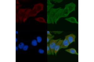 ABIN6257883 and ABIN6275262 staining Hela cells by IF/ICC.