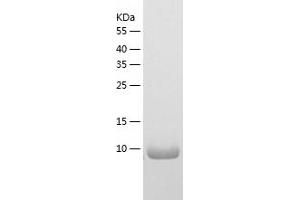 Western Blotting (WB) image for S100 Calcium Binding Protein A1 (S100A1) (AA 1-94) protein (His tag) (ABIN7286556) (S100A1 Protein (AA 1-94) (His tag))