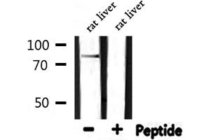 Western blot analysis of extracts from rat liver, using CDH18 Antibody.