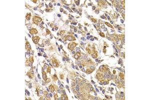 Immunohistochemistry of paraffin-embedded human stomach using METTL7B antibody at dilution of 1:100 (40x lens). (METTL7B antibody)