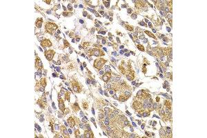 Immunohistochemistry of paraffin-embedded human stomach using METTL7B antibody at dilution of 1:100 (40x lens).
