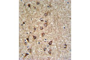 Immunohistochemistry (IHC) image for anti-Solute Carrier Family 25, Member 37 (SLC25A37) antibody (ABIN3004289) (SLC25A37 antibody)