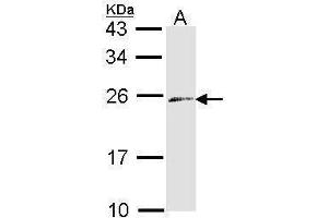 WB Image Sample (30 ug of whole cell lysate) A: Raji 12% SDS PAGE antibody diluted at 1:1000 (Endothelin 3 antibody)