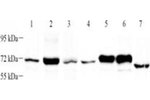 Western blot analysis of PLAP (ABIN7075090),at dilution of 1: 1000,Lane 1: HeLa cell lysate,Lane 2: HaCaT cell lysate,Lane 3: SiHa cell lysate,Lane 4: SKBR3 cell lysate,Lane 5: HepG2 cell lysate,Lane 6: A431 cell lysate,Lane 7: Mouse uterus tissue lysate (PLAP antibody)