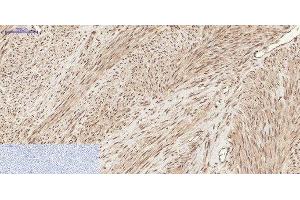 Immunohistochemistry of paraffin-embedded Human uterus tissue using Phospho-CHEK2 (Thr68) Polyclonal Antibody at dilution of 1:200 (CHEK2 antibody  (pThr68))