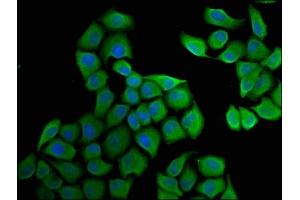 Immunofluorescence staining of Hela cells with ABIN7152029 at 1:33, counter-stained with DAPI. (HSD17B1 antibody  (AA 268-328))