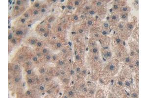 Immunohistochemistry (IHC) image for anti-Chitinase 3-Like 1 (Cartilage Glycoprotein-39) (CHI3L1) (AA 112-377) antibody (ABIN7433657)