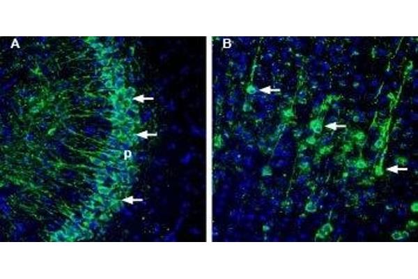 Astrotactin 1 (ASTN1) (AA 1068-1080), (C-Term), (Extracellular) antibody