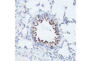 Immunohistochemistry of paraffin-embedded rat lung using ErbB2 antibody. (ErbB2/Her2 antibody  (C-Term))