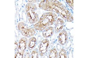 Immunohistochemistry of paraffin-embedded mouse kidney using PEG10 Rabbit pAb (ABIN3016692, ABIN3016693, ABIN1681320 and ABIN6219814) at dilution of 1:100 (40x lens). (PEG10 antibody  (AA 1-325))