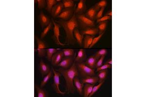 Immunofluorescence analysis of U2OS cells using Ataxin-3  Rabbit pAb (ABIN3021828, ABIN3021829, ABIN3021830, ABIN1512615 and ABIN6216049) at dilution of 1:100 (40x lens).