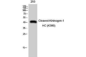 Western Blotting (WB) image for anti-Kininogen-1 Heavy Chain (Lys380) antibody (ABIN3181847) (Kininogen-1 Heavy Chain (Lys380) antibody)