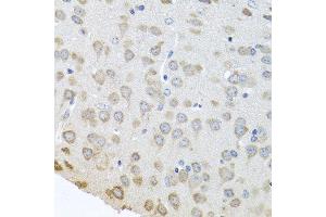 Immunohistochemistry of paraffin-embedded mouse brain using PABPC4 antibody at dilution of 1:100 (40x lens). (PABPC4 antibody)