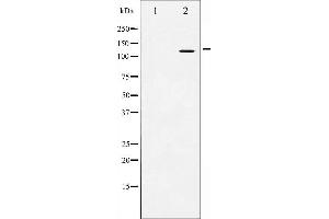 Western blot analysis of Amyloid beta A4 expression in HeLa whole cell lysates,The lane on the left is treated with the antigen-specific peptide. (APP antibody  (C-Term))