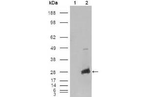 Western blot analysis using CRYAB mouse mAb against HEK293T cells transfected with the pCMV6-ENTRY control (1) and pCMV6-ENTRY CRYAB cDNA (2). (CRYAB antibody  (AA 1-175))