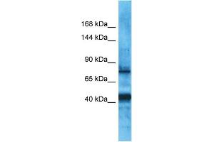 Host:  Rabbit  Target Name:  PDZRN3  Sample Type:  Uterus Tumor lysates  Antibody Dilution:  1. (PDZRN3 antibody  (Middle Region))